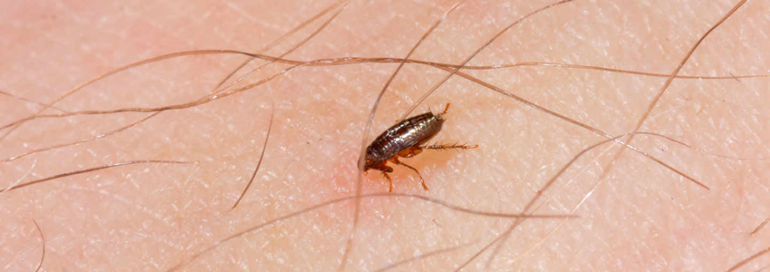 pest control services in Addis Ababa Ethiopia